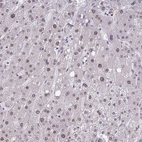Immunohistochemical staining of human liver shows moderate nuclear positivity in hepatocytes.