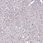 Anti-SLC9A6 Antibody