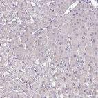 Immunohistochemical staining of human liver shows no positivity in hepatocytes as expected.