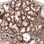 Immunohistochemical staining of human salivary gland shows moderate cytoplasmic positivity in glandular cells.