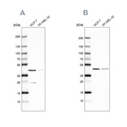 Western blot analysis using Anti-DOK7 antibody HPA059449 (A) shows similar pattern to independent antibody HPA062780 (B).