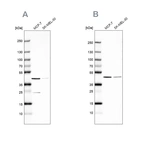 Western blot analysis using Anti-DOK7 antibody HPA059449 (A) shows similar pattern to independent antibody HPA062780 (B).