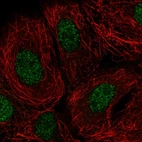 Immunofluorescent staining of human cell line MCF7 shows localization to nucleoplasm.