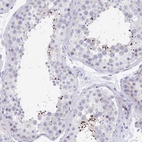 Anti-MROH2B Antibody