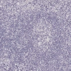 Immunohistochemical staining of human tonsil shows no positivity in non-germinal center cells as expected.