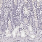 Immunohistochemical staining of human duodenum shows no positivity in glandular cells as expected.