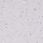 Immunohistochemical staining of human cerebral cortex shows no positivity in neurons as expected.