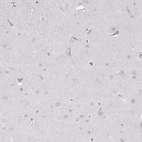 Immunohistochemical staining of human cerebral cortex shows no positivity in neurons as expected.