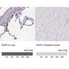 Anti-ACP5 Antibody