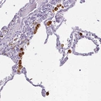 Immunohistochemical staining of human lung shows strong granular cytoplasmic positivity in macrophages.