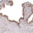 Anti-WNT5A Antibody