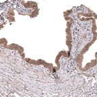 Immunohistochemical staining of human fallopian tube shows moderate cytoplasmic positivity in glandular cells.