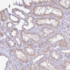 Anti-OR4P4 Antibody