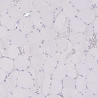Immunohistochemical staining of human skeletal muscle shows no positivity in myocytes as expected.