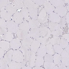 Immunohistochemical staining of human skeletal muscle shows no positivity in myocytes as expected.