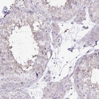 Immunohistochemical staining of human testis shows weak cytoplasmic positivity in cells in seminiferous ducts.