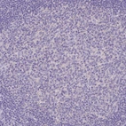 Immunohistochemical staining of human lymph node shows no positivity in germinal center cells as expected.