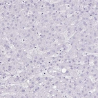 Immunohistochemical staining of human liver shows no positivity in hepatocytes as expected.