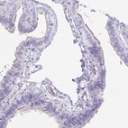 Anti-OR5J2 Antibody