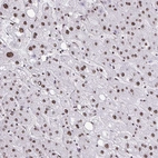 Anti-NRBF2 Antibody