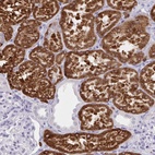 Anti-UGT3A2 Antibody