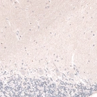 Immunohistochemical staining of human cerebellum shows no positivity in Purkinje cells as expected.