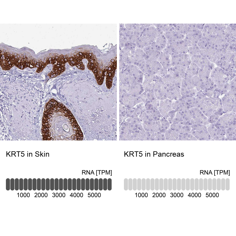 Anti-KRT5 Antibody