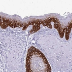 Immunohistochemical staining of human Skin shows strong cytoplasmic positivity in squamous epithelial cells.