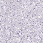 Anti-KRT5 Antibody