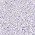 Immunohistochemical staining of human Liver shows no positivity in hepatocytes as expected.