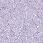 Immunohistochemical staining of human Pancreas shows no positivity in exocrine glandular cells as expected.