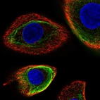 Immunofluorescent staining of human cell line hTCEpi shows localization to intermediate filaments.
