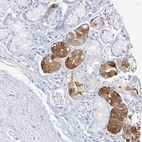 Anti-PRR20A Antibody