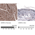 Anti-IGFBP2 Antibody