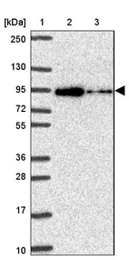 Lane 1: Marker [kDa] 250, 130, 95, 72, 55, 36, 28, 17, 10_br/_Lane 2: Human cell line RT-4_br/_Lane 3: Human cell line U-251MG sp