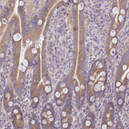 Anti-CEACAM18 Antibody