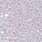 Immunohistochemical staining of human liver shows no positivity in hepatocytes as expected.