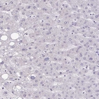 Immunohistochemical staining of human liver shows no positivity in hepatocytes as expected.