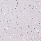 Immunohistochemical staining of human skeletal muscle shows no positivity in myocytes as expected.