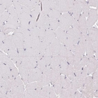 Immunohistochemical staining of human skeletal muscle shows no positivity in myocytes as expected.