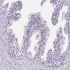 Immunohistochemical staining of human prostate shows no positivity in glandular cells as expected.