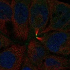 Immunofluorescent staining of human cell line CACO-2 shows localization to midbody.