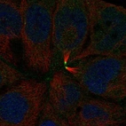 Immunofluorescent staining of human cell line CACO-2 shows localization to midbody.