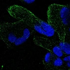 Anti-ZNF302 Antibody