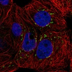 Anti-CACNB3 Antibody