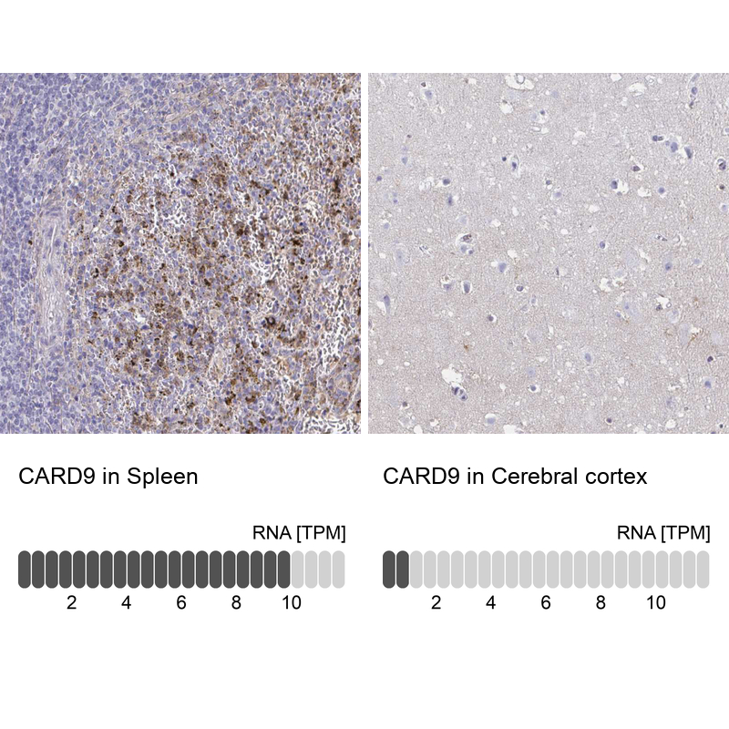Anti-CARD9 Antibody