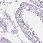 Immunohistochemical staining of human testis shows weak to moderate cytoplasmic positivity in cells in seminiferous ducts.