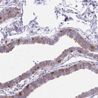 Immunohistochemical staining of human fallopian tube shows weak to moderate cytoplasmic positivity in glandular cells.
