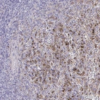 Immunohistochemical staining of human spleen shows weak to moderate cytoplasmic positivity in a subset of leukocytes.