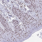 Immunohistochemical staining of human skin shows moderate nuclear positivity in squamous epithelial cells.